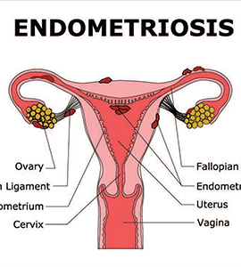 best ivf center in hadapsar