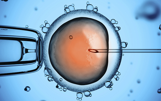 IVF Specialist in Aundh